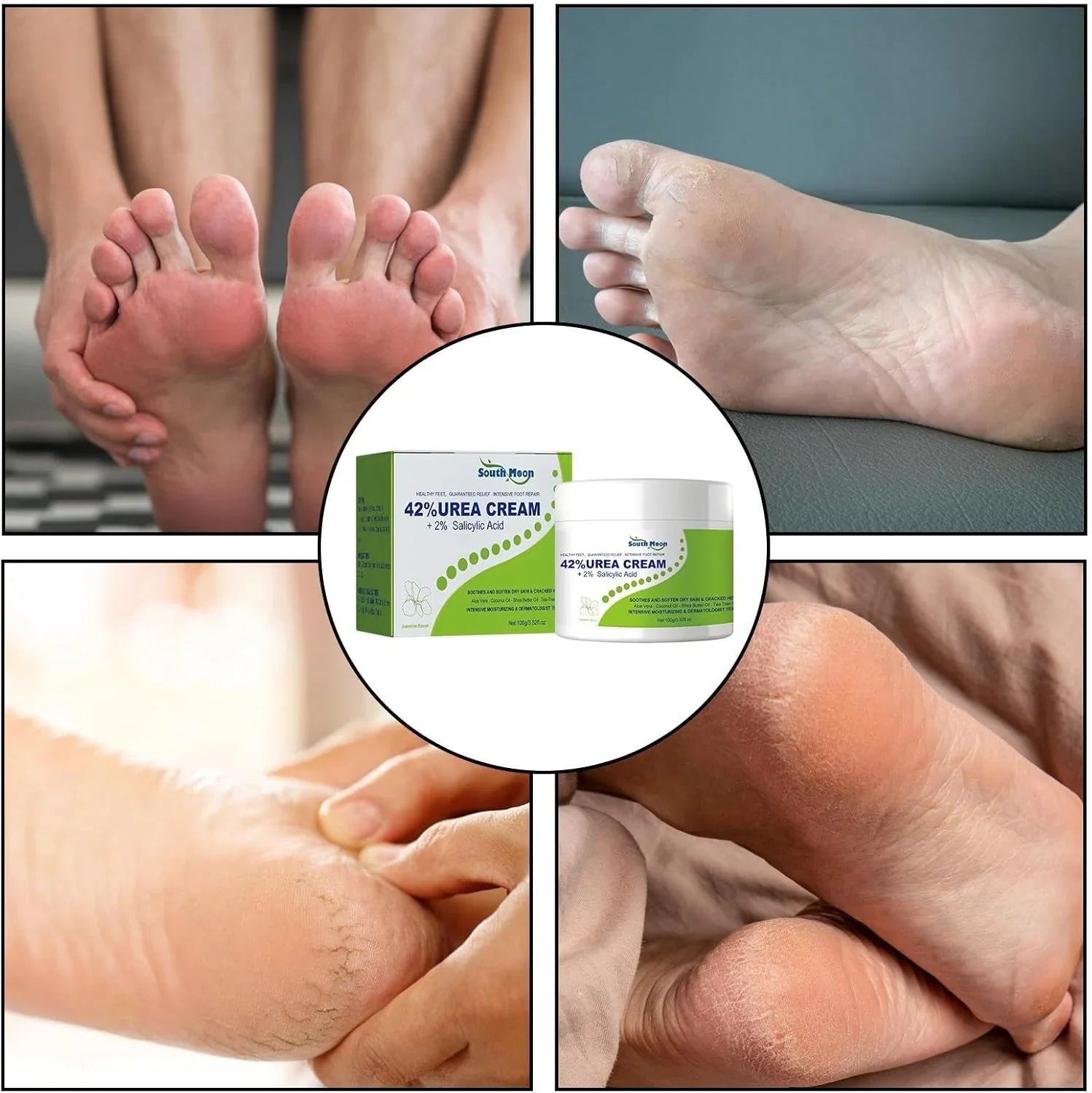 South Moon Urea Cream with 2% Salicylic Acid, moisturizing skincare product for dry and rough skin in a white tub.